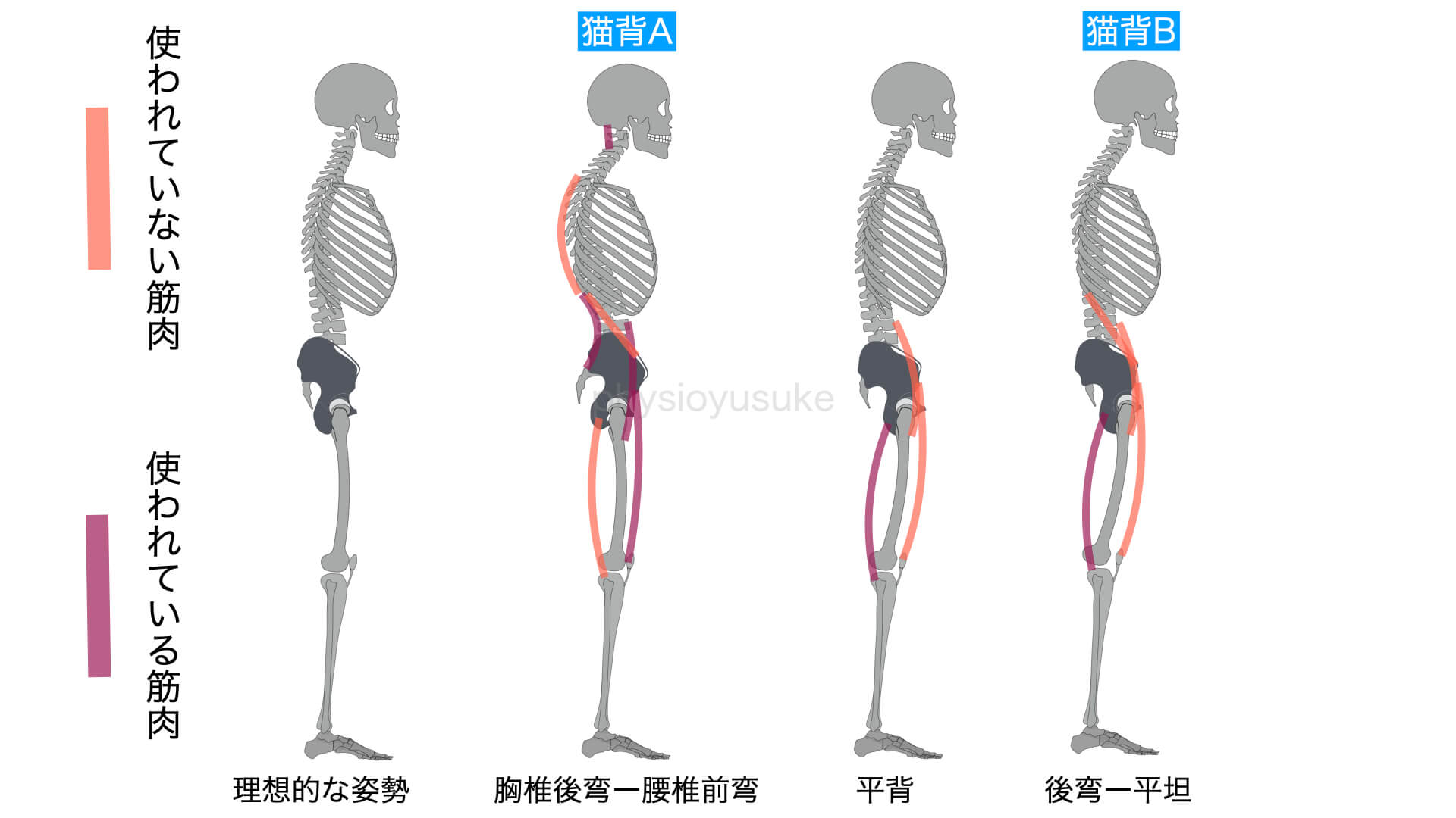 かんたん猫背 ねこぜ の治し方 原因と解決方法 ユウスケ 筋トレ怪我ゼロプロジェクト Blog