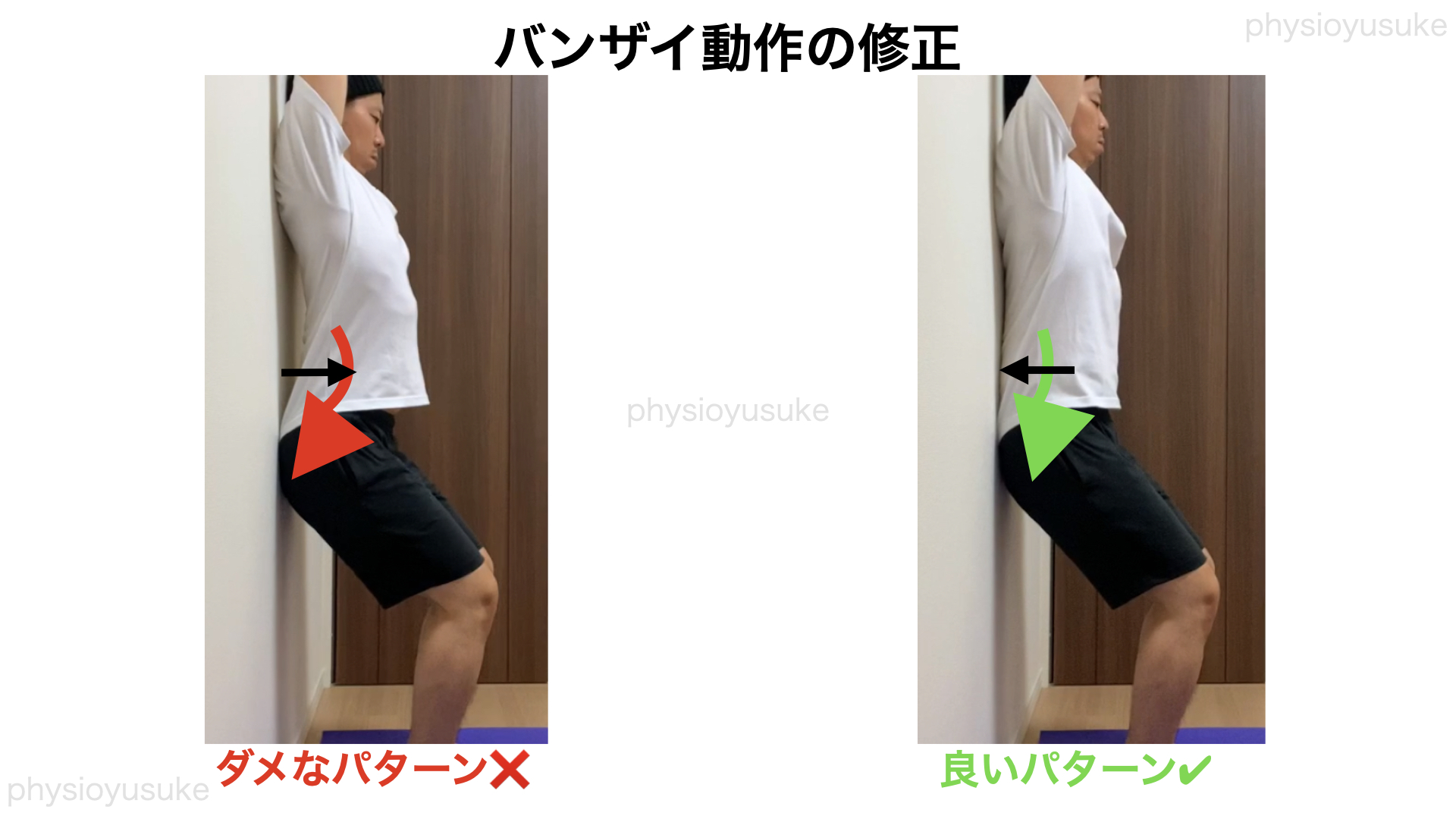 伸展型腰痛原因